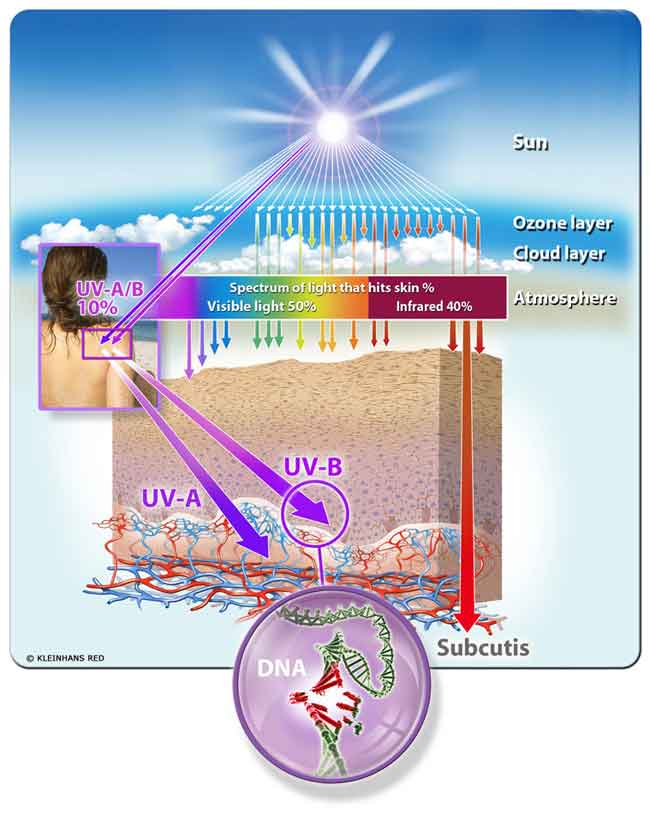 Zonlicht spectrum en huidbeschadiging