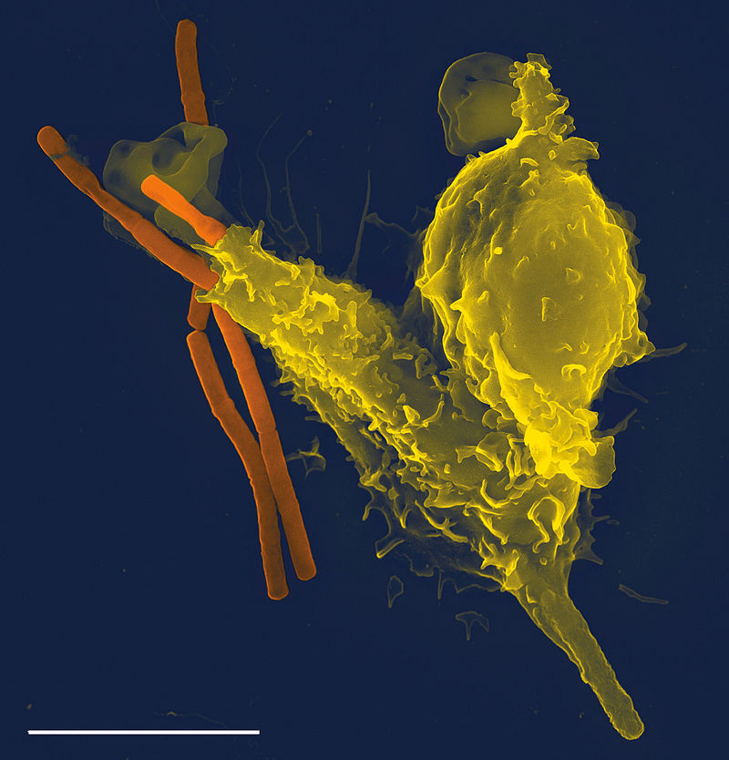 Microscopische opname van een neutrofiele granulocyt (geel) die een Bacillus anthracis (miltvuurbacterie, oranje) opslokt